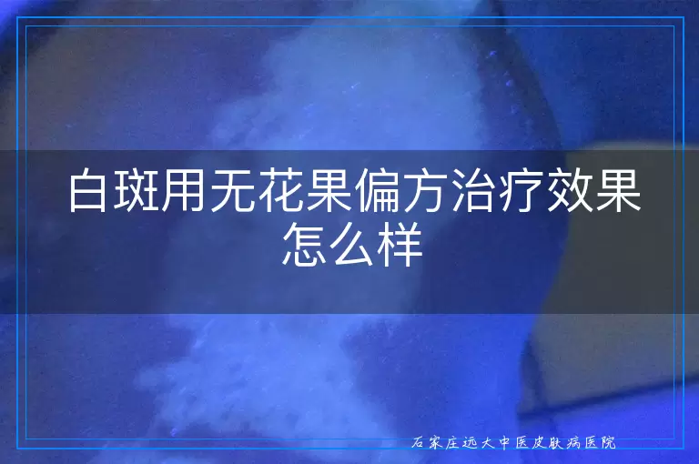 白斑用无花果偏方治疗效果怎么样