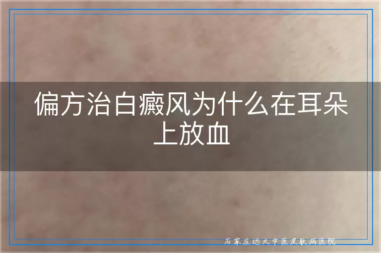 偏方治白癜风为什么在耳朵上放血