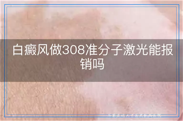 白癜风做308准分子激光能报销吗