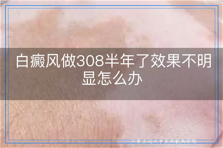 白癜风做308半年了效果不明显怎么办