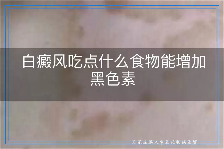 白癜风吃点什么食物能增加黑色素
