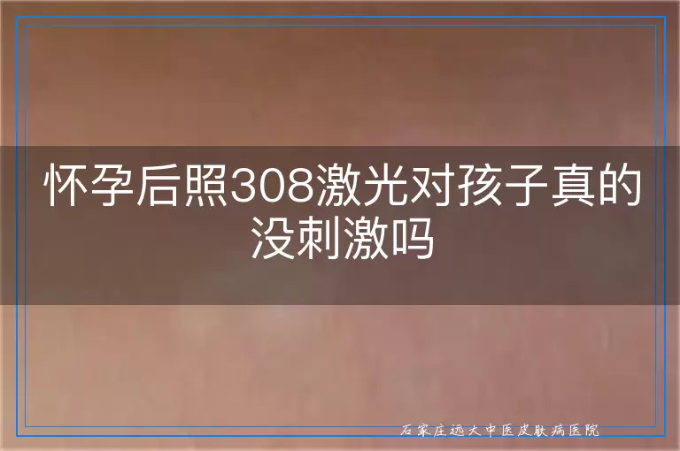 怀孕后照308激光对孩子真的没刺激吗