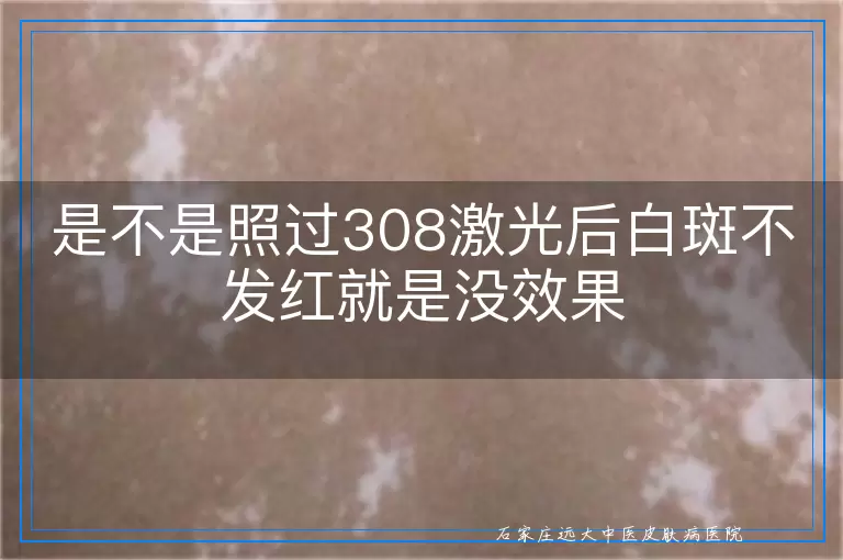 是不是照过308激光后白斑不发红就是没效果
