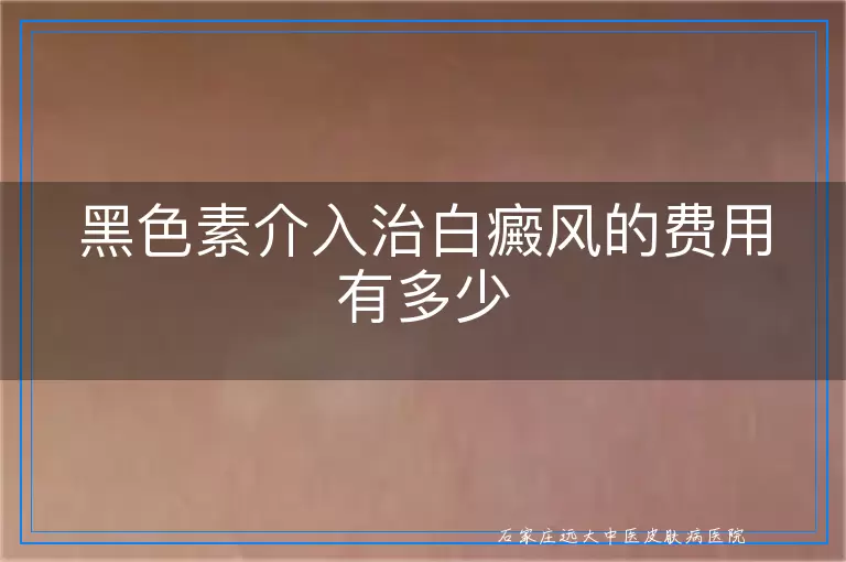 黑色素介入治白癜风的费用有多少