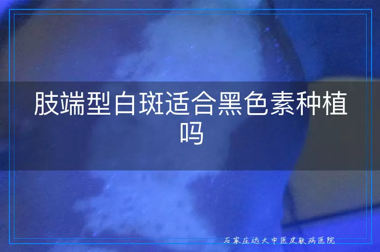 肢端型白斑适合黑色素种植吗