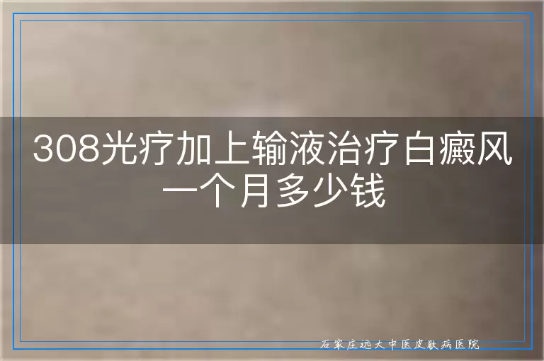 308光疗加上输液治疗白癜风一个月多少钱