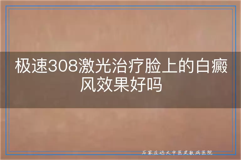 极速308激光治疗脸上的白癜风效果好吗