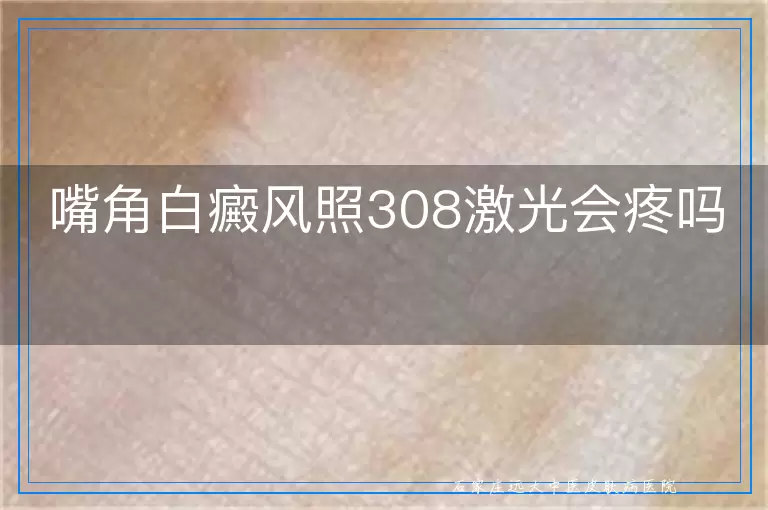 嘴角白癜风照308激光会疼吗