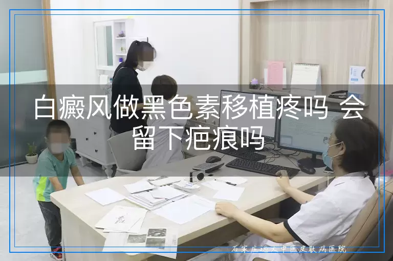 白癜风做黑色素移植疼吗 会留下疤痕吗