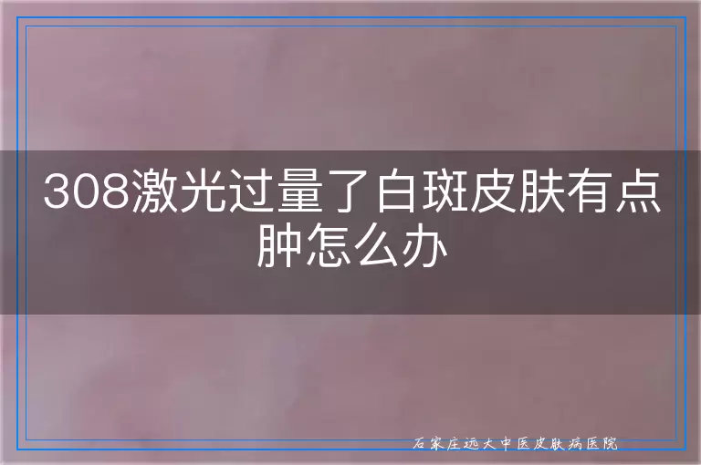 308激光过量了白斑皮肤有点肿怎么办