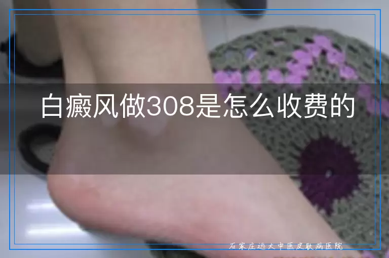 白癜风做308是怎么收费的