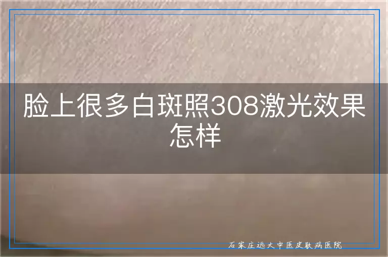 脸上很多白斑照308激光效果怎样