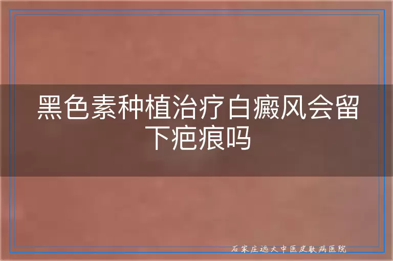 黑色素种植治疗白癜风会留下疤痕吗