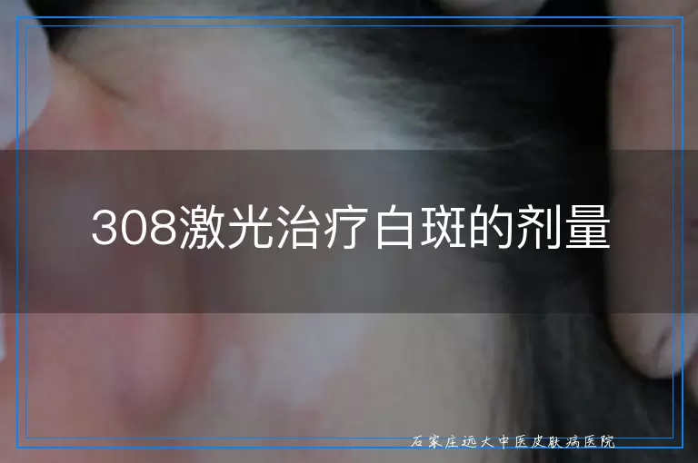 308激光治疗白斑的剂量