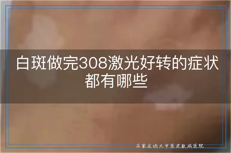 白斑做完308激光好转的症状都有哪些