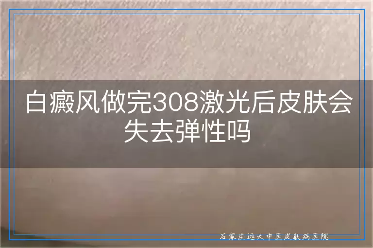 白癜风做完308激光后皮肤会失去弹性吗