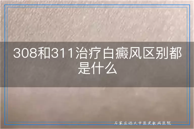 308和311治疗白癜风区别都是什么