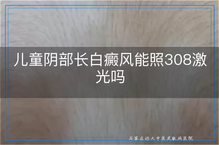 儿童阴部长白癜风能照308激光吗