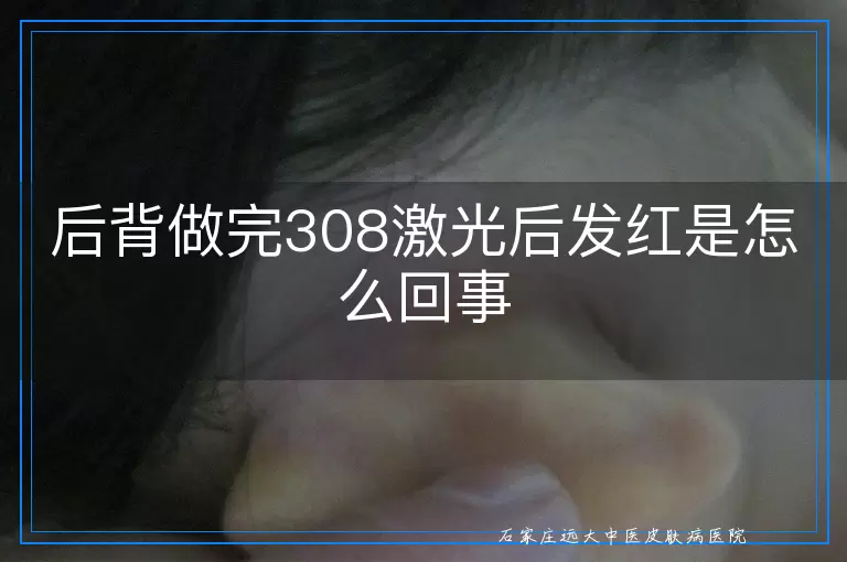 后背做完308激光后发红是怎么回事