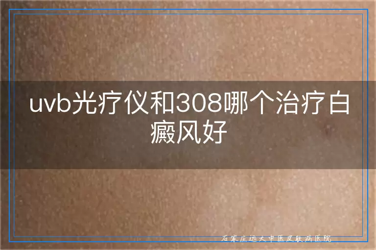 uvb光疗仪和308哪个治疗白癜风好