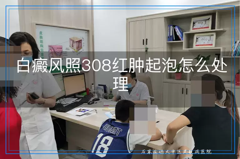 白癜风照308红肿起泡怎么处理