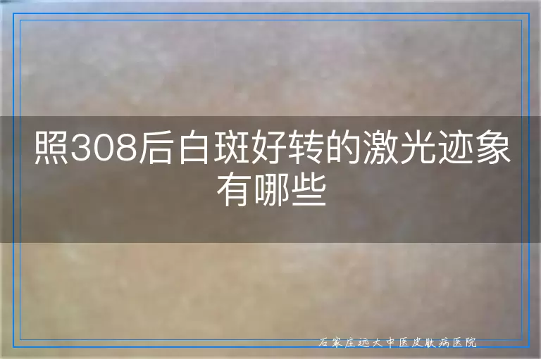 照308后白斑好转的激光迹象有哪些