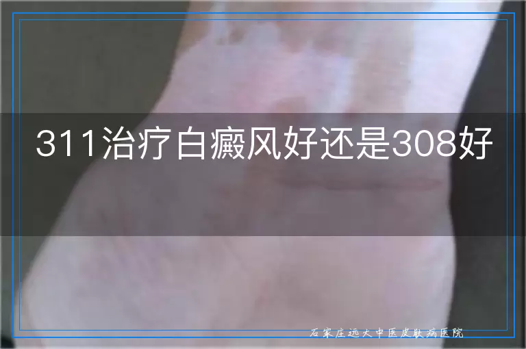 311治疗白癜风好还是308好