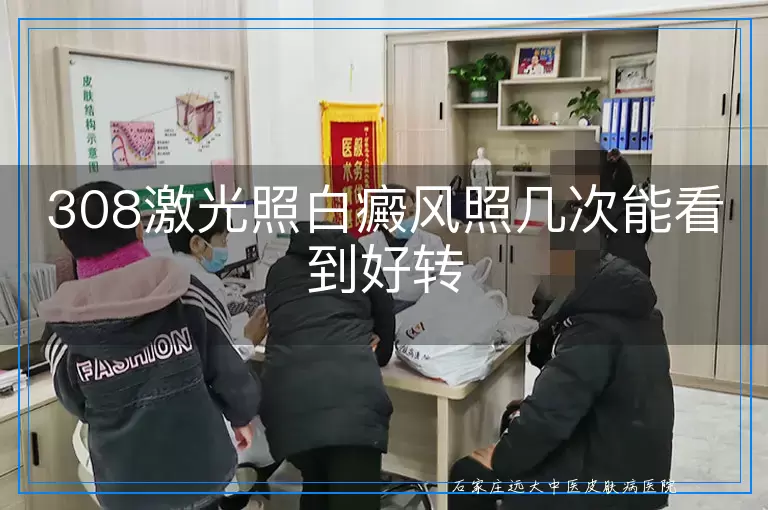 308激光照白癜风照几次能看到好转