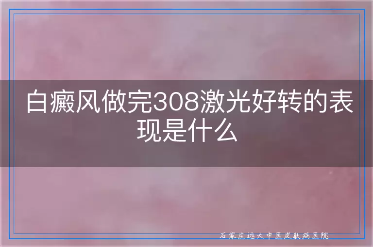 白癜风做完308激光好转的表现是什么