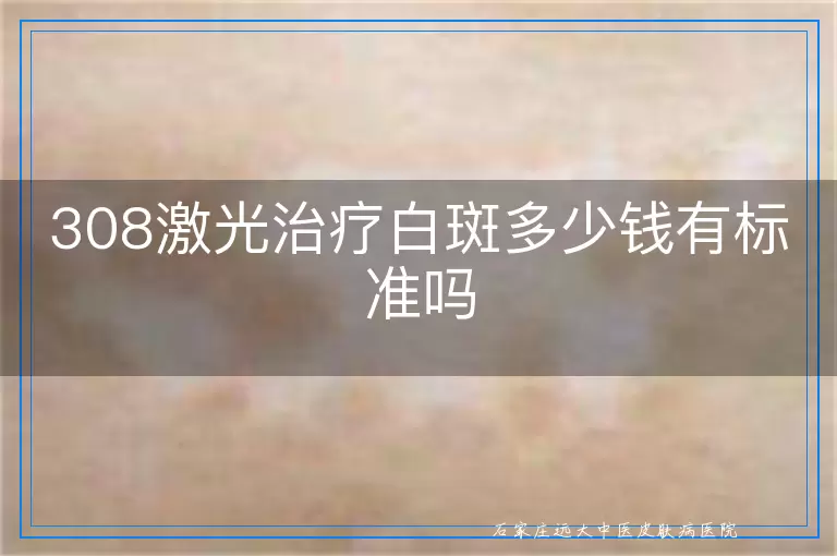 308激光治疗白斑多少钱有标准吗
