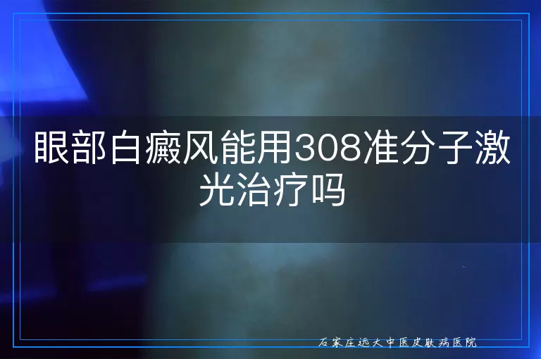 眼部白癜风能用308准分子激光治疗吗