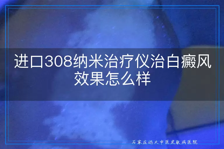 进口308纳米治疗仪治白癜风效果怎么样