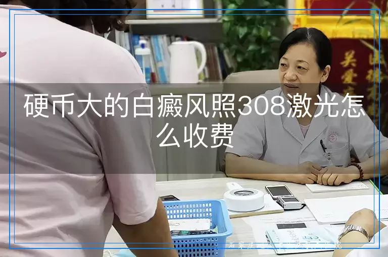 硬币大的白癜风照308激光怎么收费
