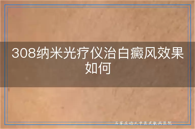 308纳米光疗仪治白癜风效果如何