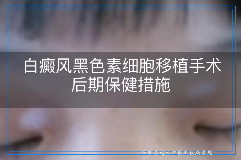 白癜风黑色素细胞移植手术后期保健措施