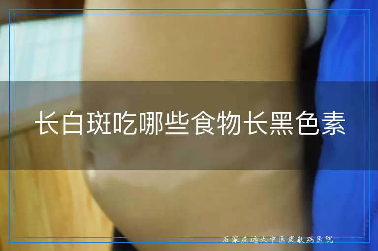 长白斑吃哪些食物长黑色素