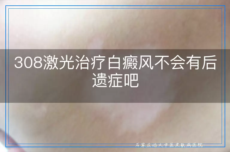 308激光治疗白癜风不会有后遗症吧