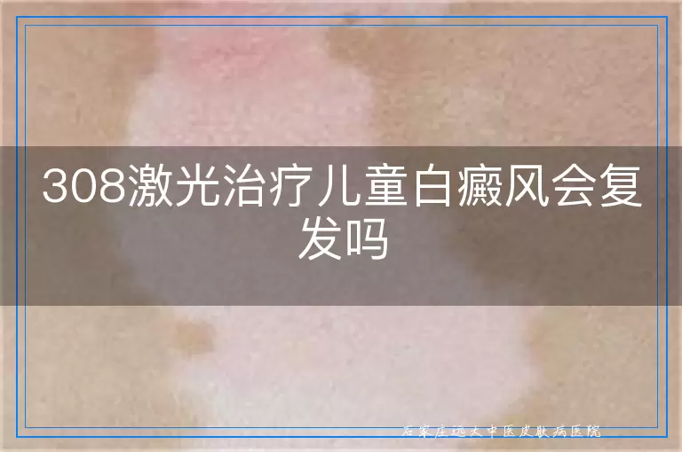 308激光治疗儿童白癜风会复发吗