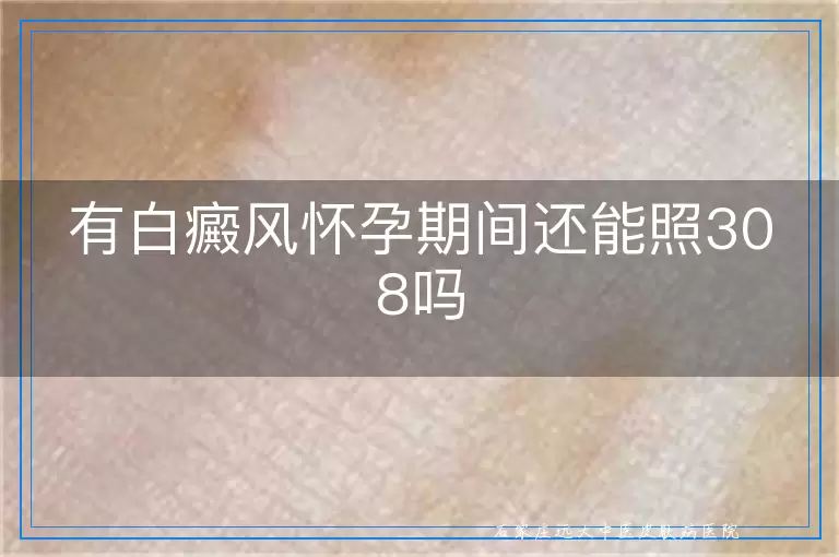 有白癜风怀孕期间还能照308吗
