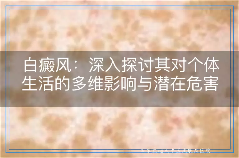 白癜风：深入探讨其对个体生活的多维影响与潜在危害