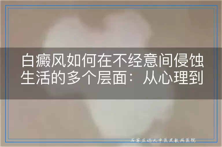 白癜风如何在不经意间侵蚀生活的多个层面：从心理到社交的深远影响