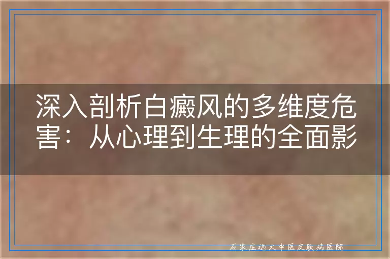深入剖析白癜风的多维度危害：从心理到生理的全面影响