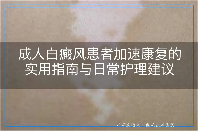 成人白癜风患者加速康复的实用指南与日常护理建议
