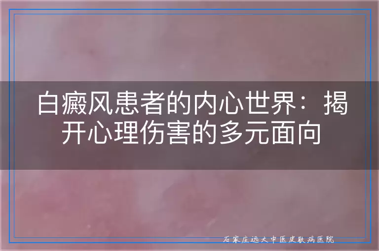 白癜风患者的内心世界：揭开心理伤害的多元面向