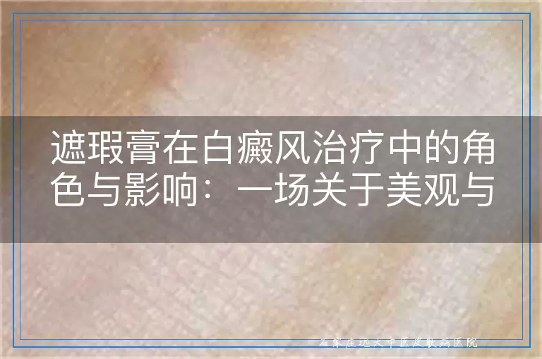 遮瑕膏在白癜风治疗中的角色与影响：一场关于美观与疗效的探讨