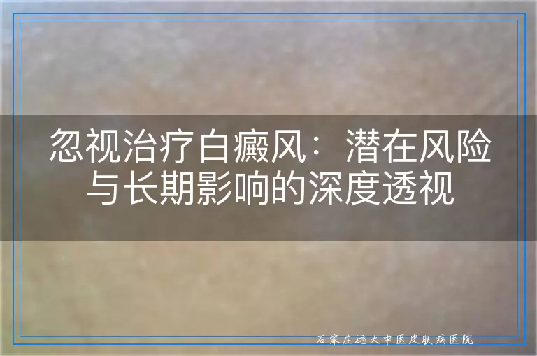 忽视治疗白癜风：潜在风险与长期影响的深度透视