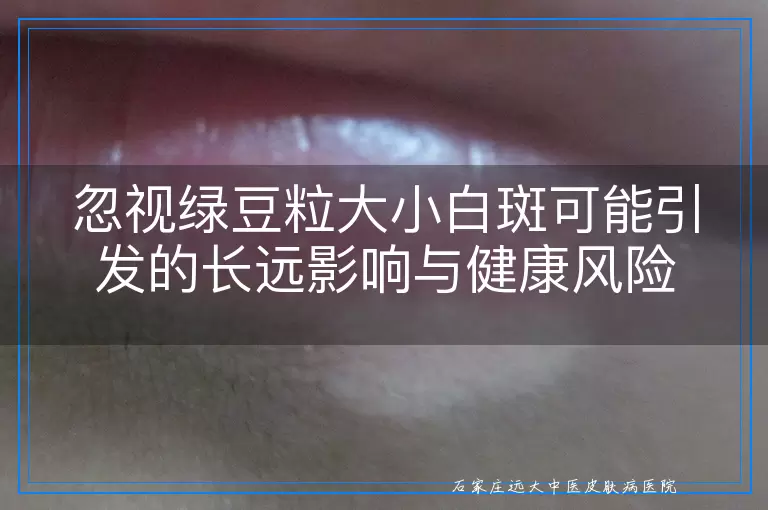忽视绿豆粒大小白斑可能引发的长远影响与健康风险