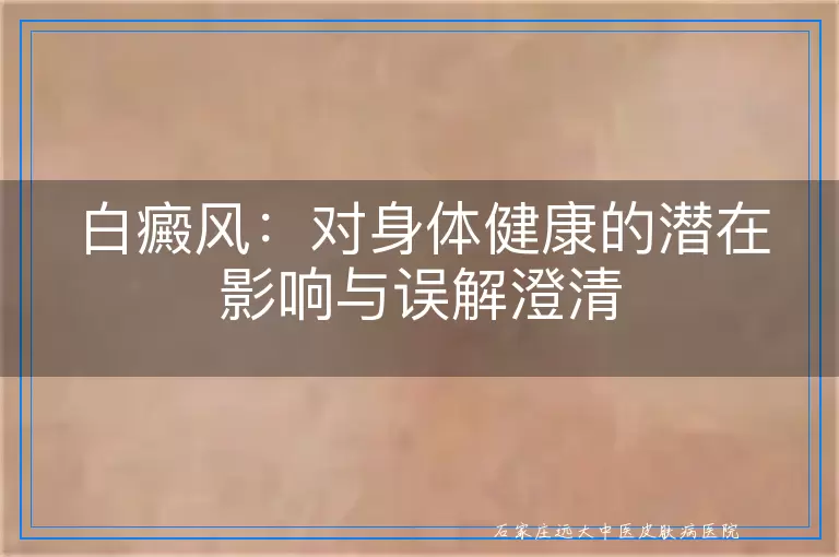 白癜风：对身体健康的潜在影响与误解澄清