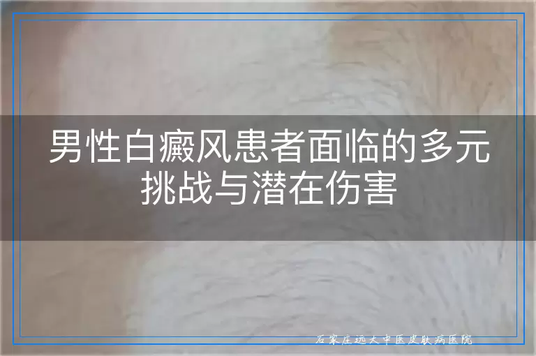 男性白癜风患者面临的多元挑战与潜在伤害