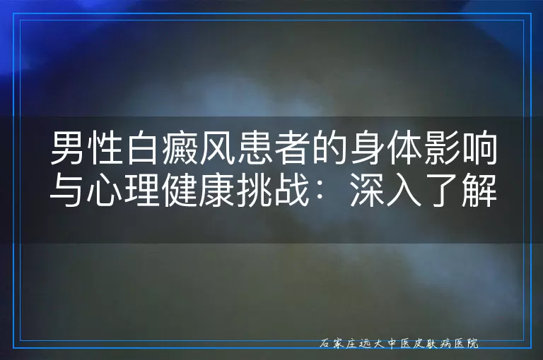 男性白癜风患者的身体影响与心理健康挑战：深入了解白斑的多维度影响